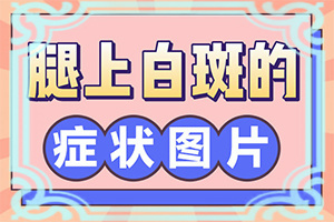 Χ׵ô(׵κ)