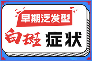 儿童白点癫风怎么治疗了又复发