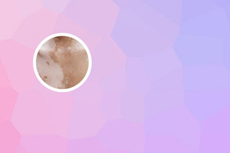 为什么眼角有白色斑点的小块