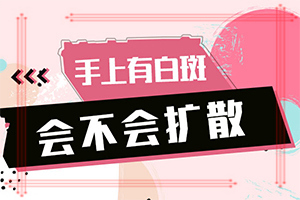 晕痣白癜怎样晕痣白斑治疗方法？避免哪些误解