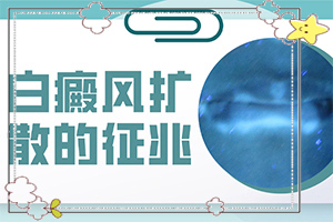 白点癫风治的好吗