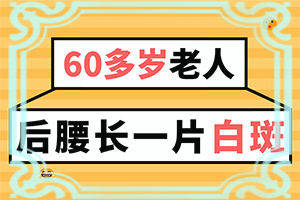 遗传性白颠疯怎么治疗