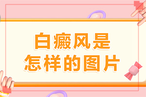治疗白巅峰哪好