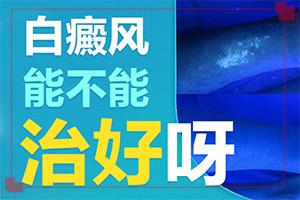 小患者有白癫风能治的好吗?治身性白癫要