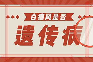 白点癫风影响寿命吗男性怎么治疗