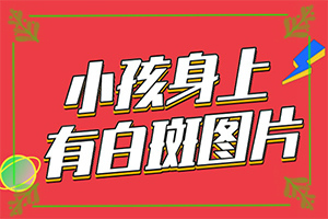 小孩白颠疯病治好比例