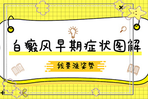 儿童手指上有白斑怎么回事
