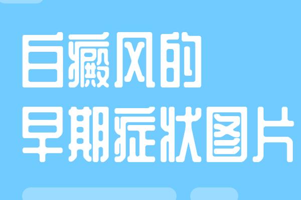 ɢ԰֢״ʲô
