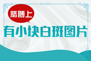 白点癫风能治好吗药物治疗多少钱一次
