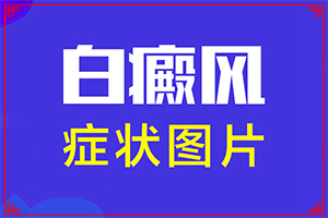 皮肤白斑是什么原因