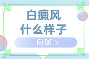 白颠疯十年可以治好吗
