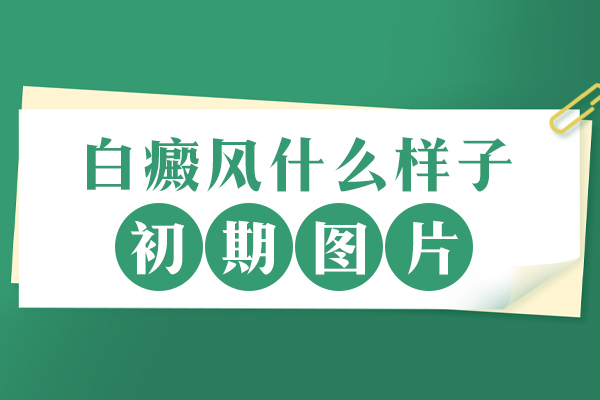 初期白癜风皮肤白斑症状是什么样