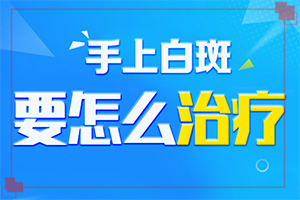 白点癫风用什么药膏治